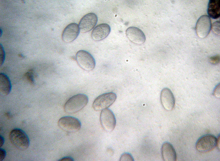 Su bruciato (cfr. Pyronema sp.)